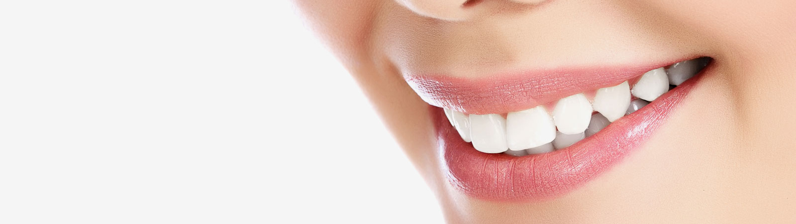 Tooth Whitening